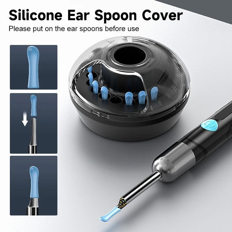 Otoscope Vidéo WiFi – Caméra d'Oreille HD pour Nettoyage Précis